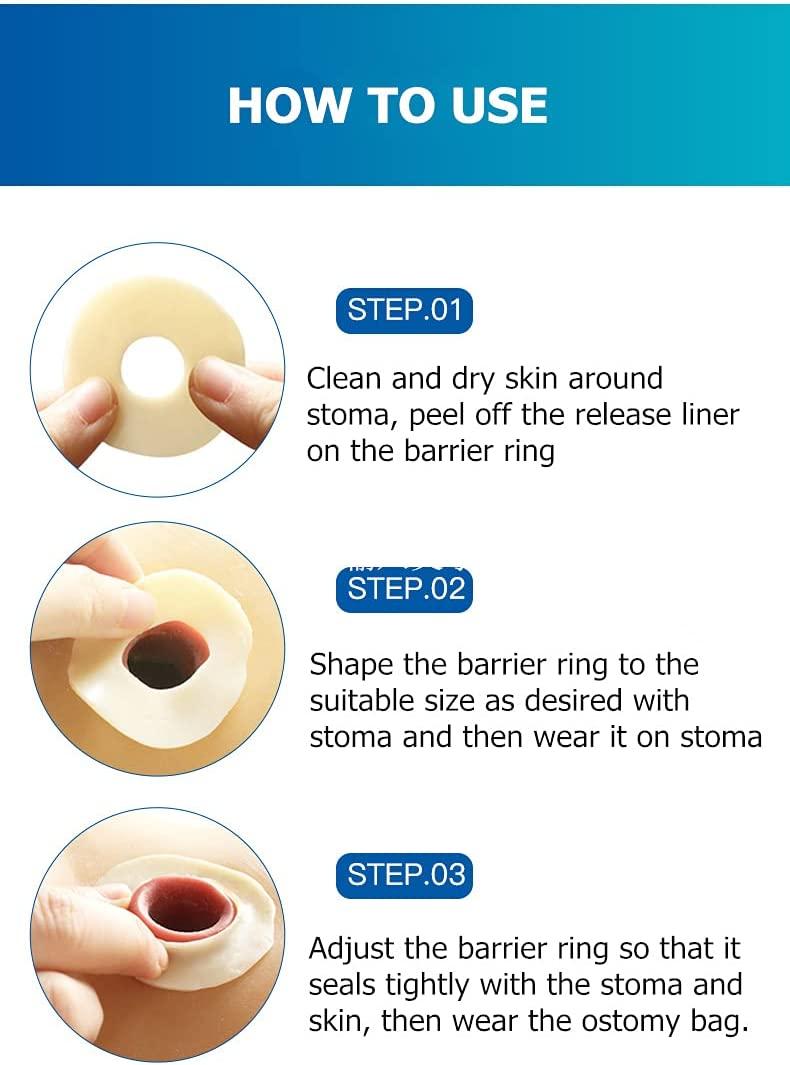 KONWEDA Ostomy Barrier Rings Pack of 10 Skinfriendly and Leakproof