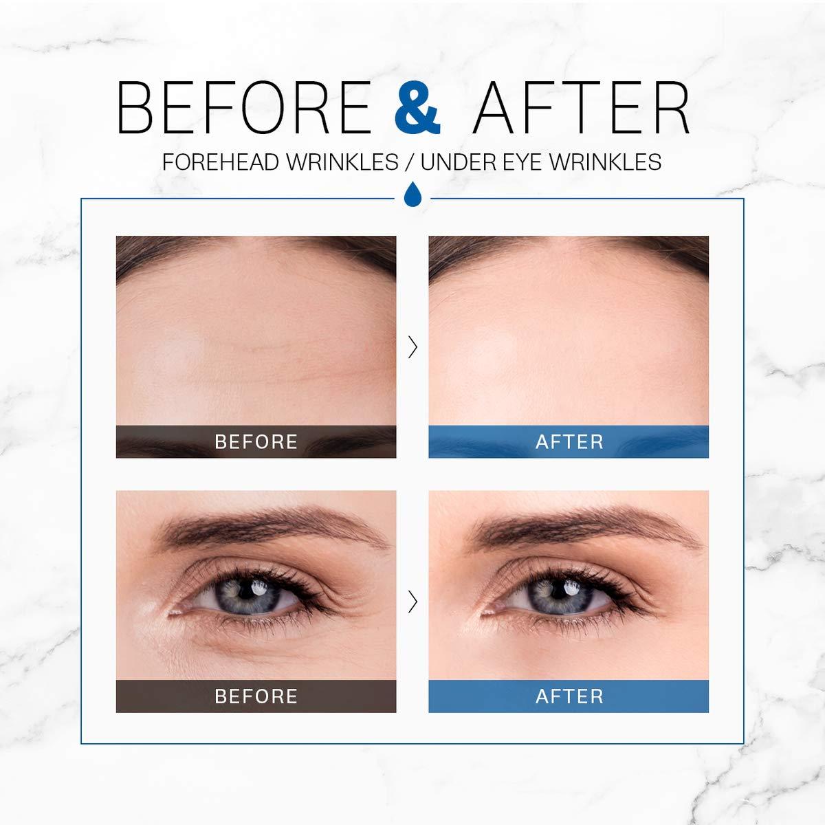 GD11 HYDRACELL AQUA AMPOULE STEM CELL BOOSTER SERUM for Antiaging