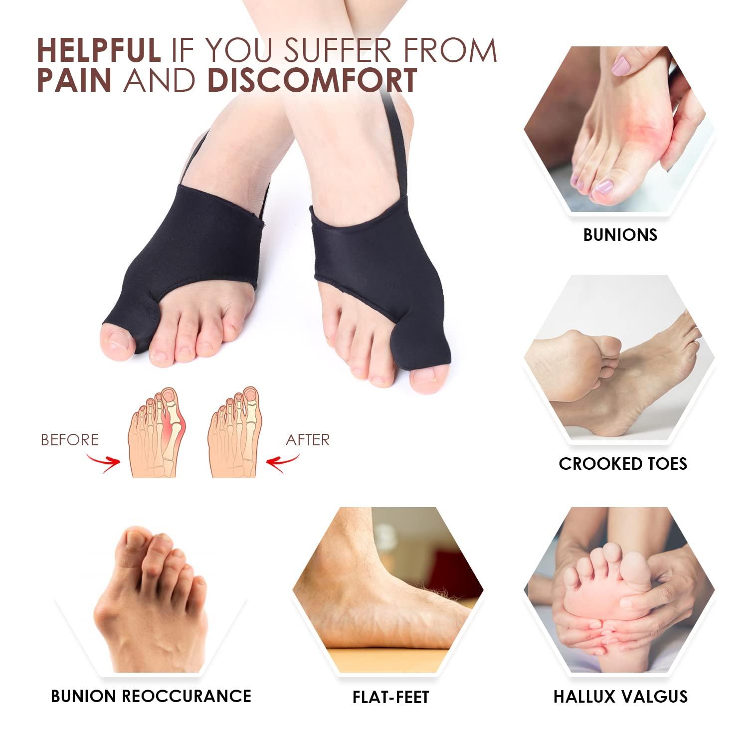 Bunion Corrector For Women & Men and Bunion Toe Separators, Effective