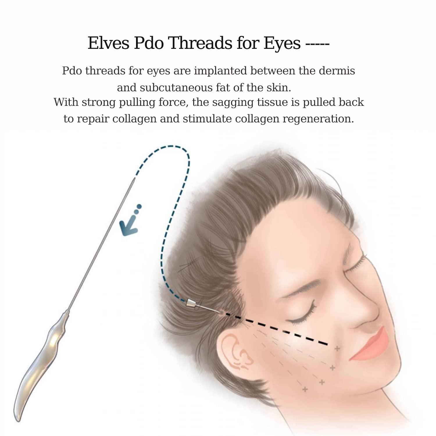 High-Grade Pdo Eyebrow Thread Lift Mono Screw with 30g 38mm Model - China  Eyes Pdo Thread, Eye Care Pdo Thread Mono