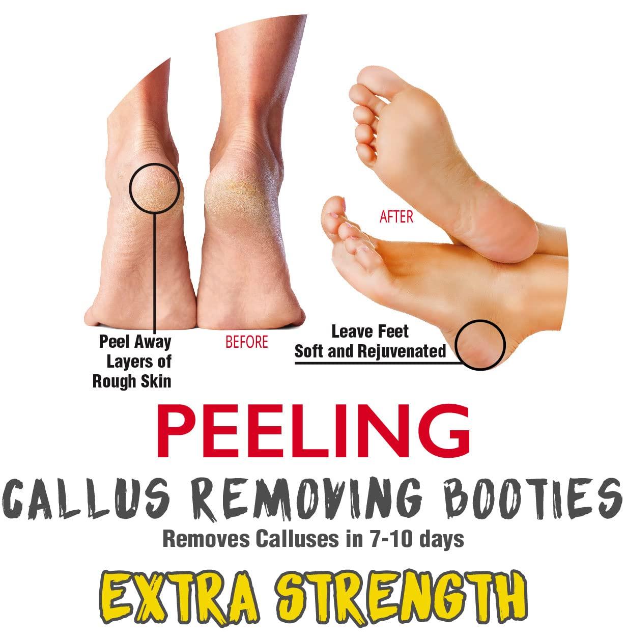 OEM 2 Pairs Exfoliating Best Effective Dead Skin Removing Foot