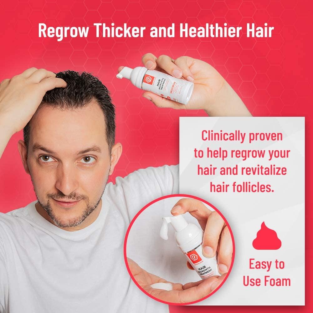 Minoxidil 5 Topical Foam (3 Month Supply) Regenivade 5 Minoxidil