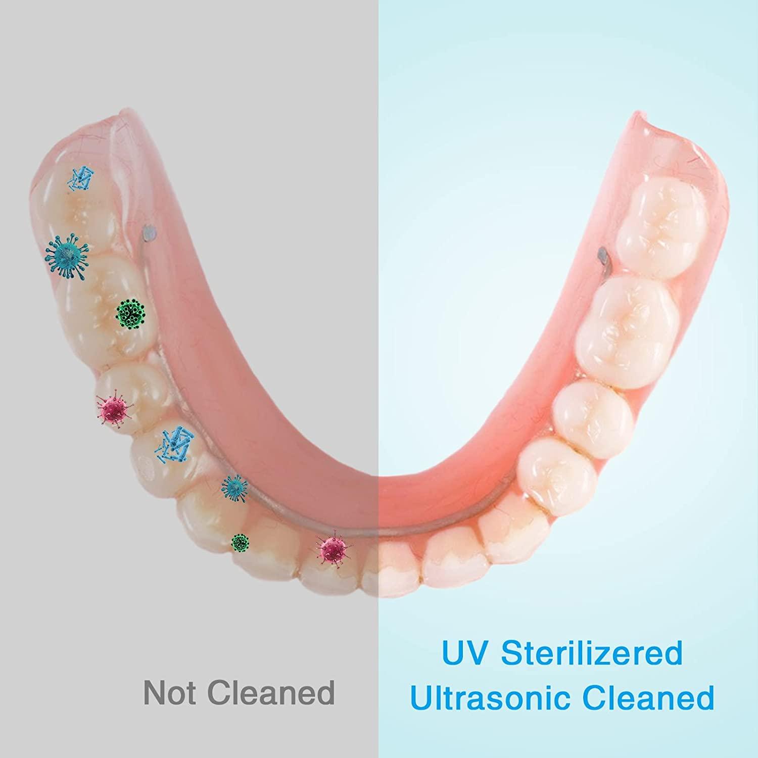 Voraiya Ultrasonic UV Cleaner for Dental Appliances & Jewelry
