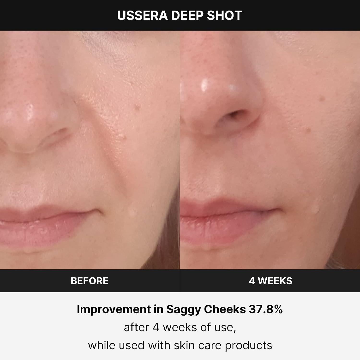 Medicube Age-R USSERA - Advanced Anti-Aging Device | Buy Now