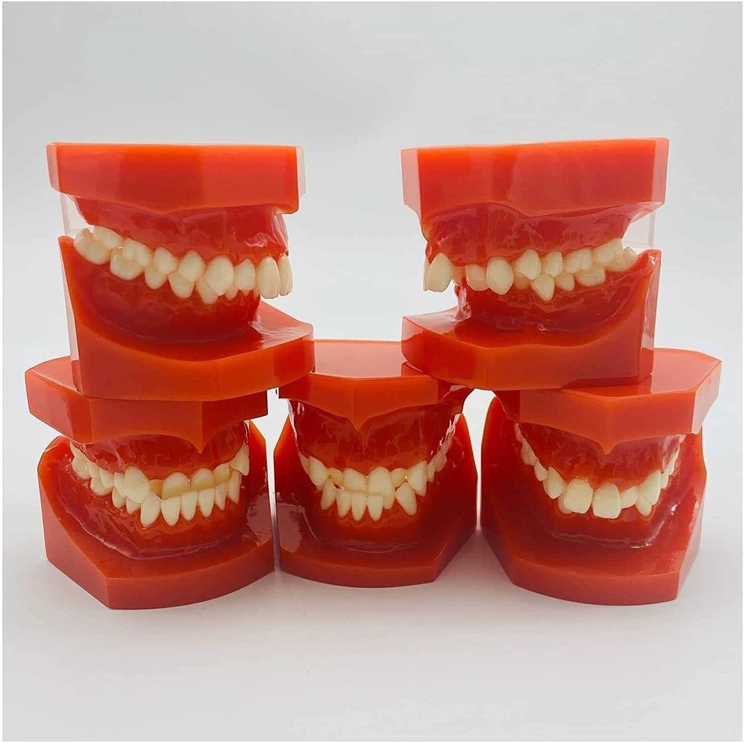 Teeth Educational Model - Orthodontic Classification & Lesson Model for ...