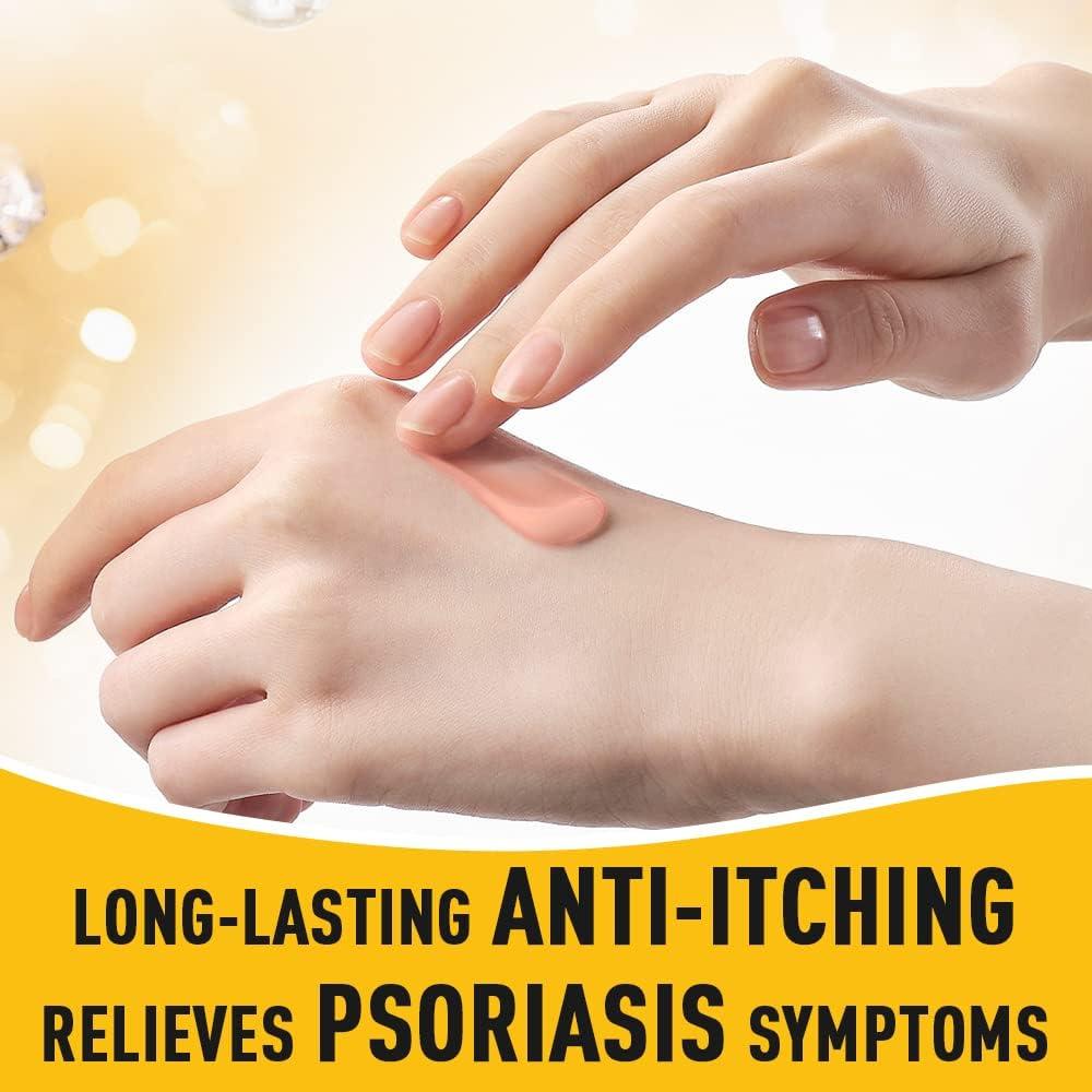 Sumifun Psoriasis Cream Psoriasis Eczema Cream AntiItch Cream for
