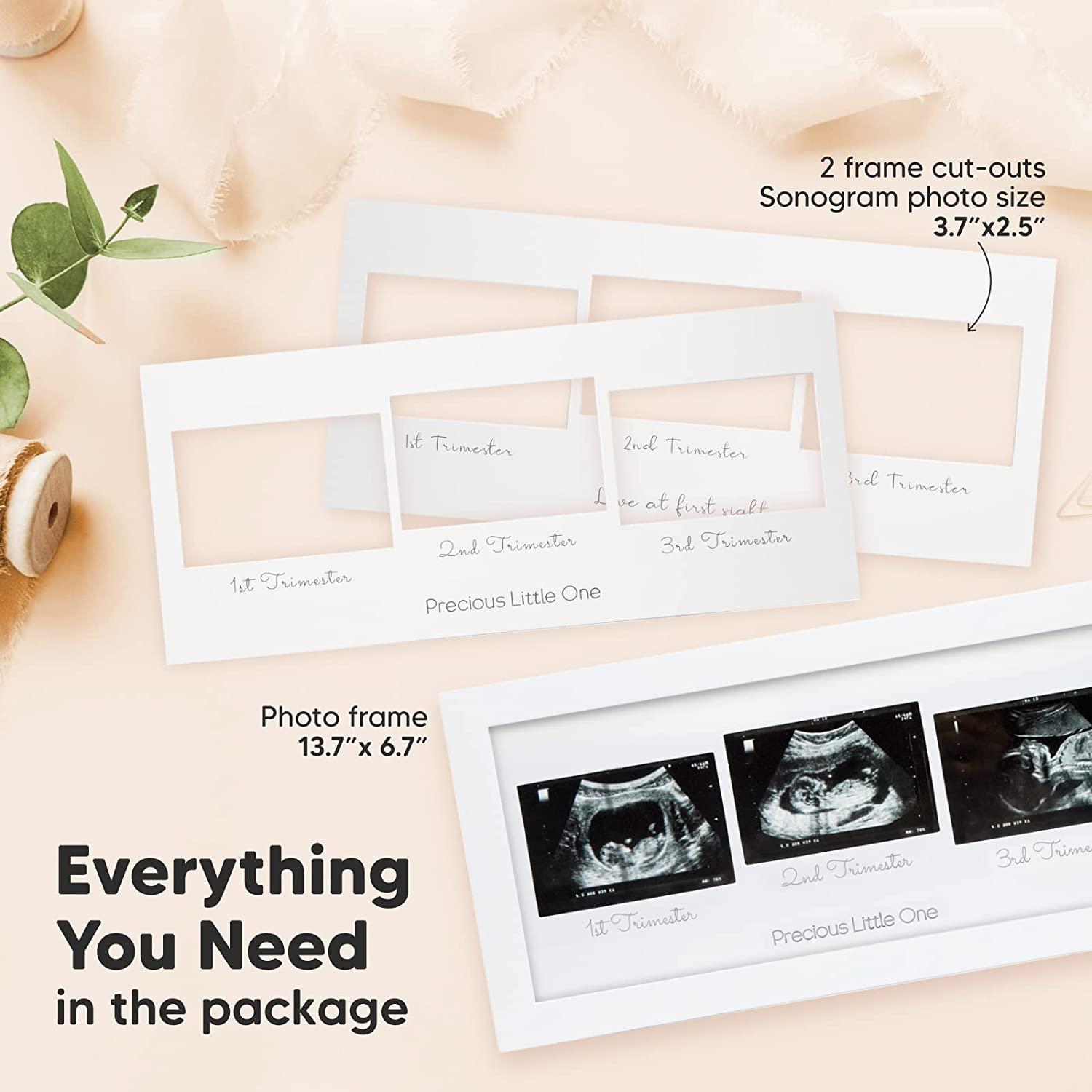 Sonogram Picture Frame Trio Ultrasound Picture Frames For Mom To Be Gift Baby Ultrasound