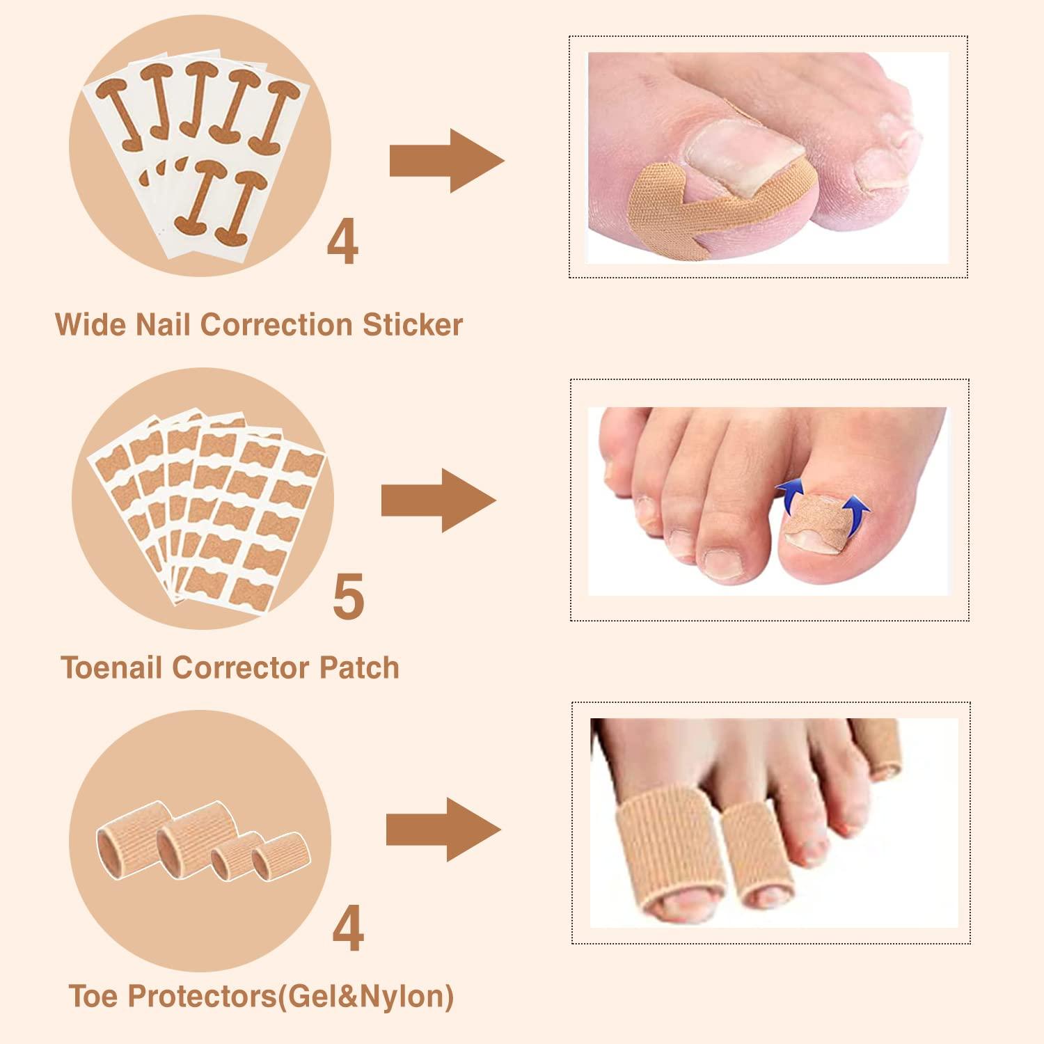 Ingrown Toenail Removal Kit 107PCS Ingrown Toenail Treatment Kit