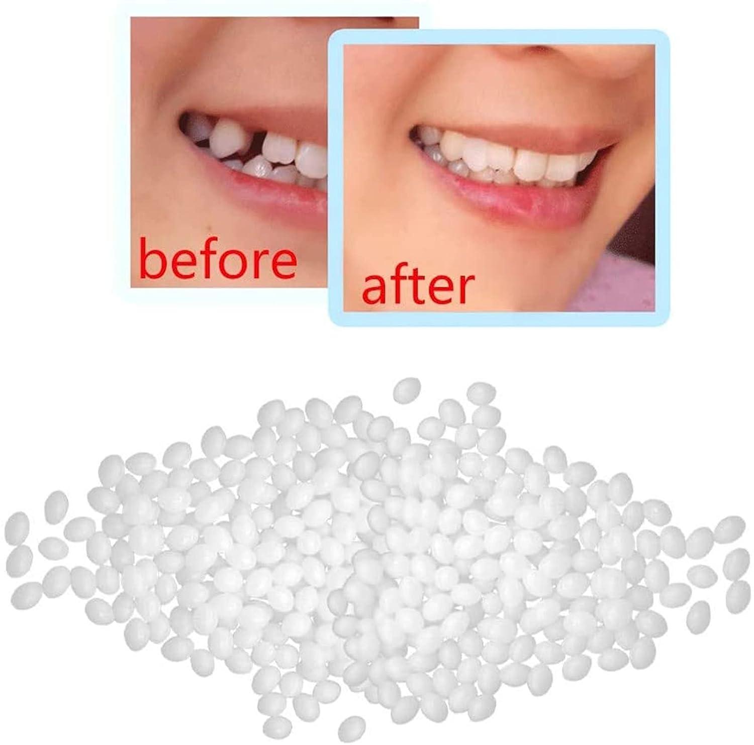 Tooth Repair Kit,Moldable Fake Teeth Replacement,Temporary Tooth Repair Kit  Permanent Tooth Repair Granules Smile Kit for Missing Chipped Broken Teeth