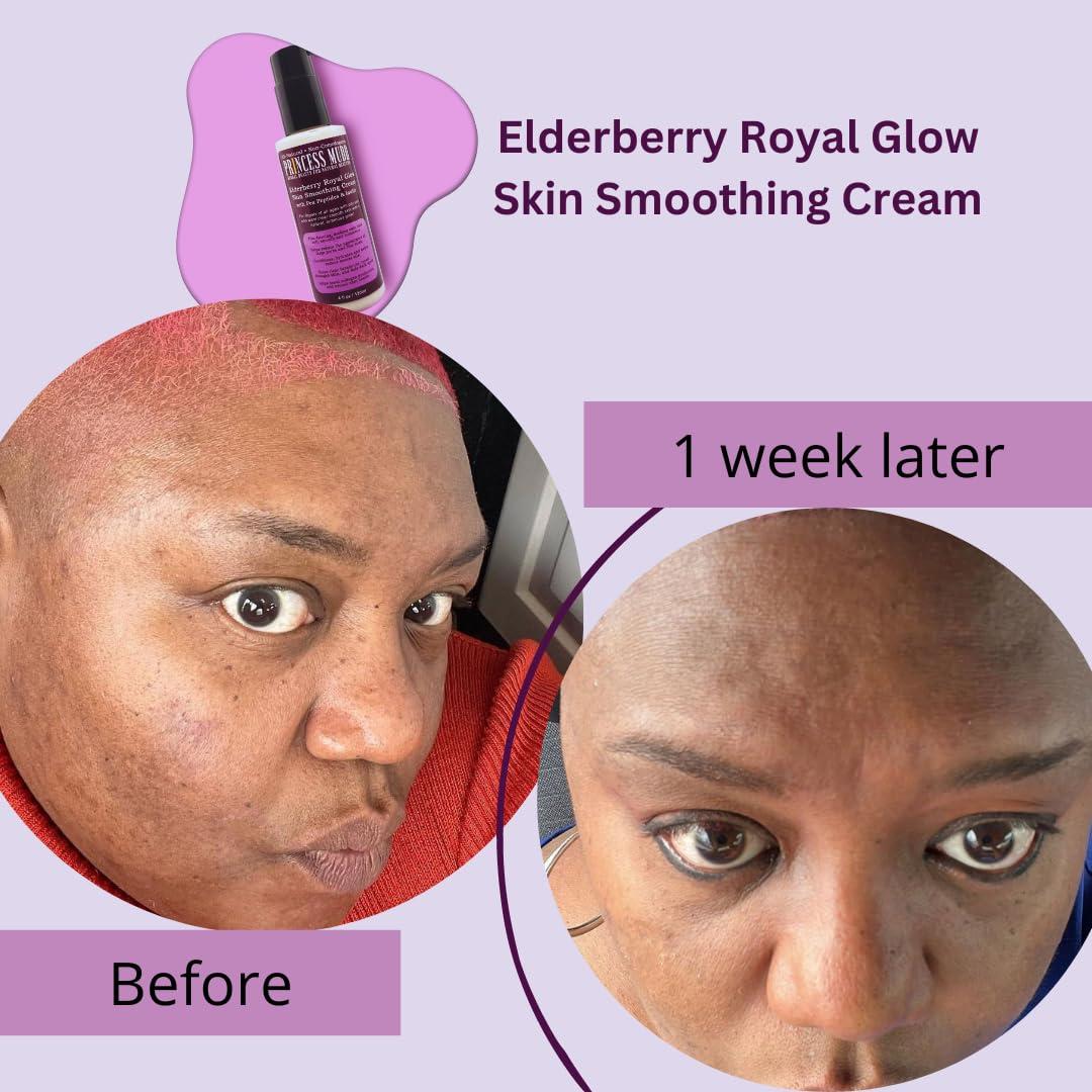 Princess Mudd Aloe Vera Face Cream - Age-Defying Radiance Non-Comedogenic  with Chicory Root & Elderberry - 4oz | International Shipping | Buy Now  with Express International Delivery | GoSupps.com