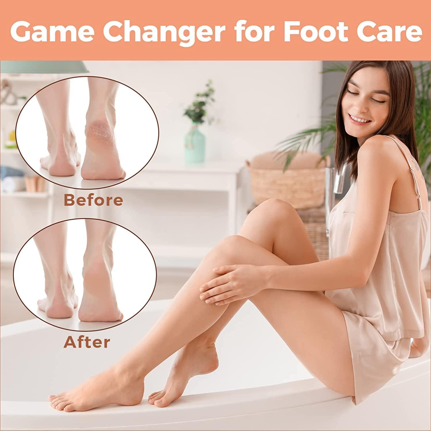 Foot File Foot Scrubber Pedicure - Callus Remover for Feet Easkep  Professional Grater Rasp Foot Scraper Corns Callous Removers Cracked Dead  Skin