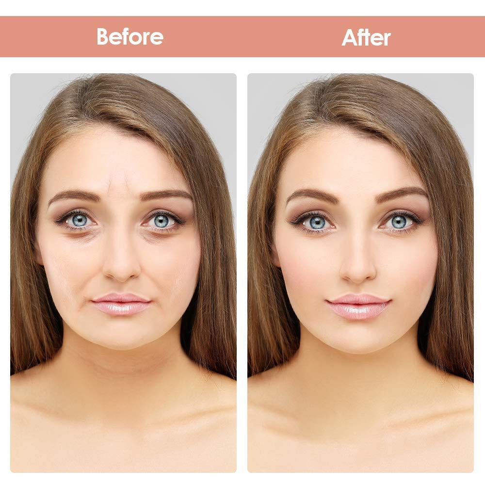 256pcs Facial Wrinkle Smoothing Patches Anti Wrinkle Face Strips