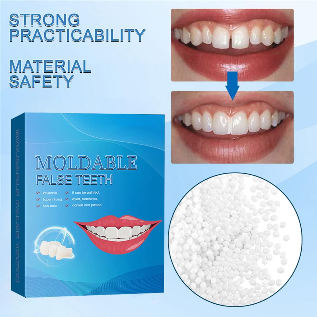Temporary Tooth Repair Kit A1 Moldable Fake Teeth Replacement Glue for Missing & Broken Teeth