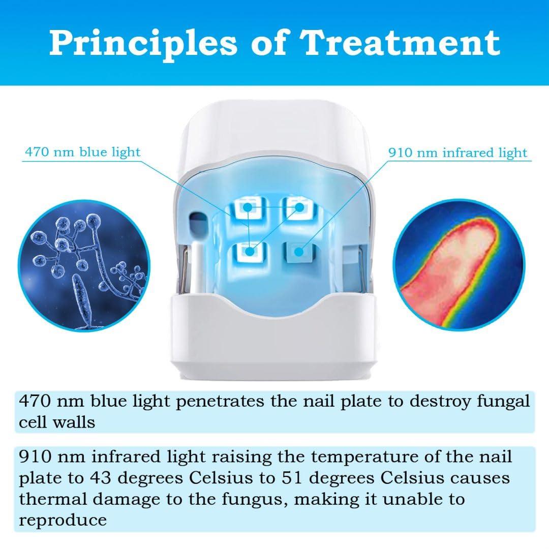 Nail Fungus Cleaning Laser Treatment Device Effective HomeUse