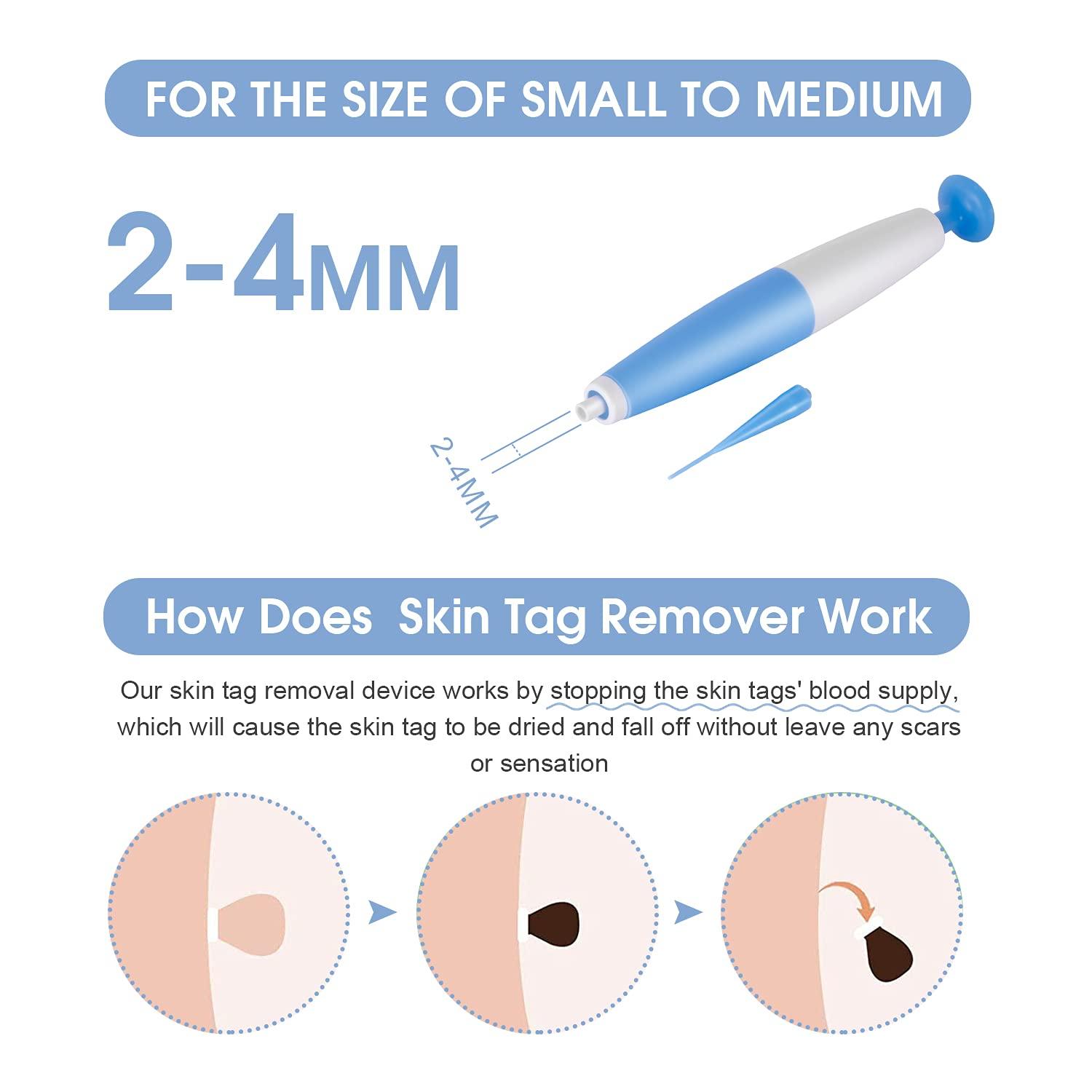 Skin Tag Remover Kit with 36 Repair Patches Easy Application Tool for