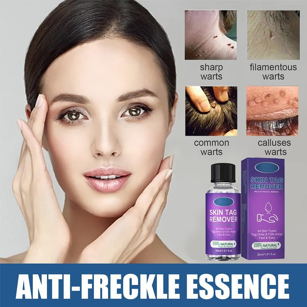 LDREAMAM Skin Tag Removal Wart & Mole Remover Skin Tag Removal
