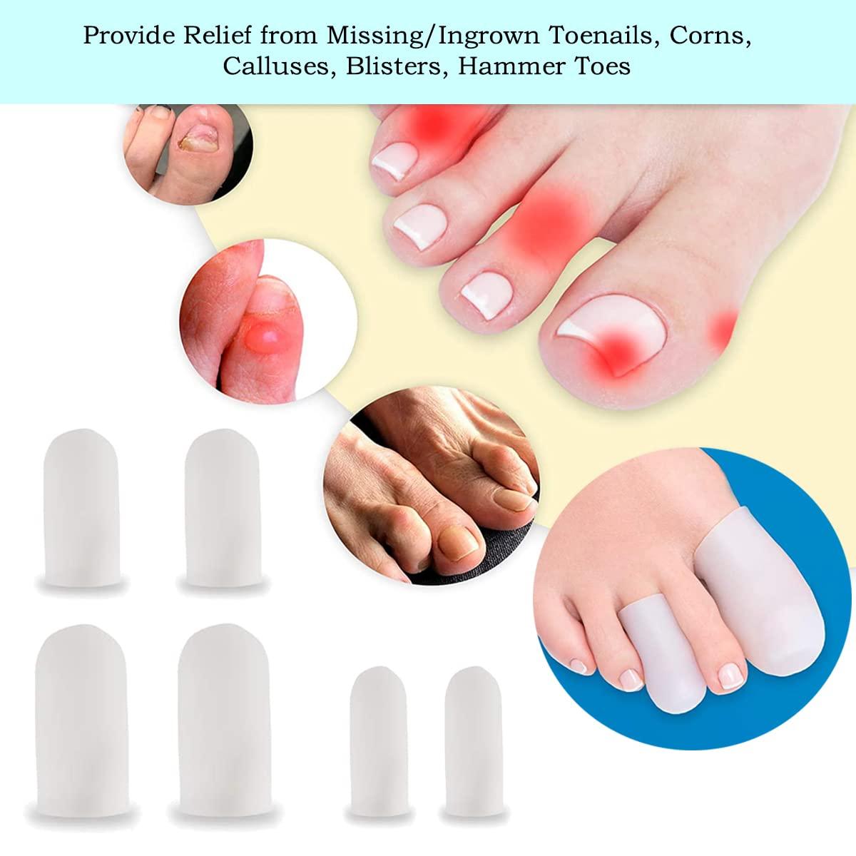 Ingrown Toenail Correction Treatment Kit 50 pcs Corrector Strips, 5pcs Clippers, 6pcs Toe