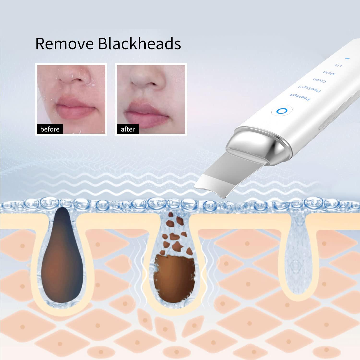 COSBEAUTY Skin Scrubber 4-in-1 Versatile Skincare Device for