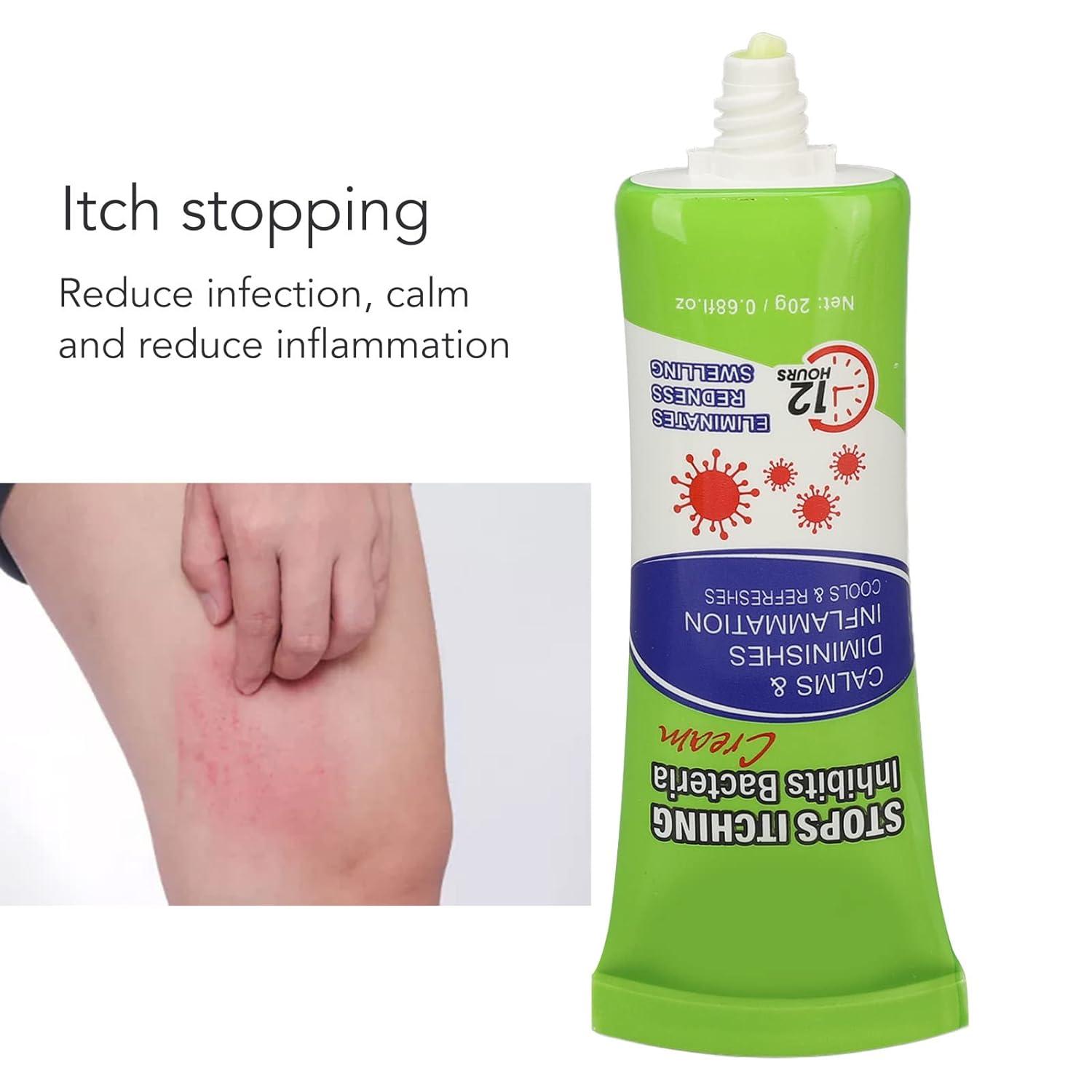 Itch Relief Cream Itch Stoppping Cream Moisturizing Itch Relief Balm