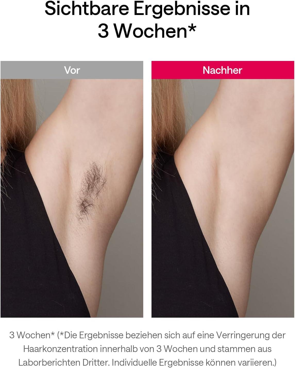 Ulike Air IPL Hair Removal Device Sapphire Ice Cooling for