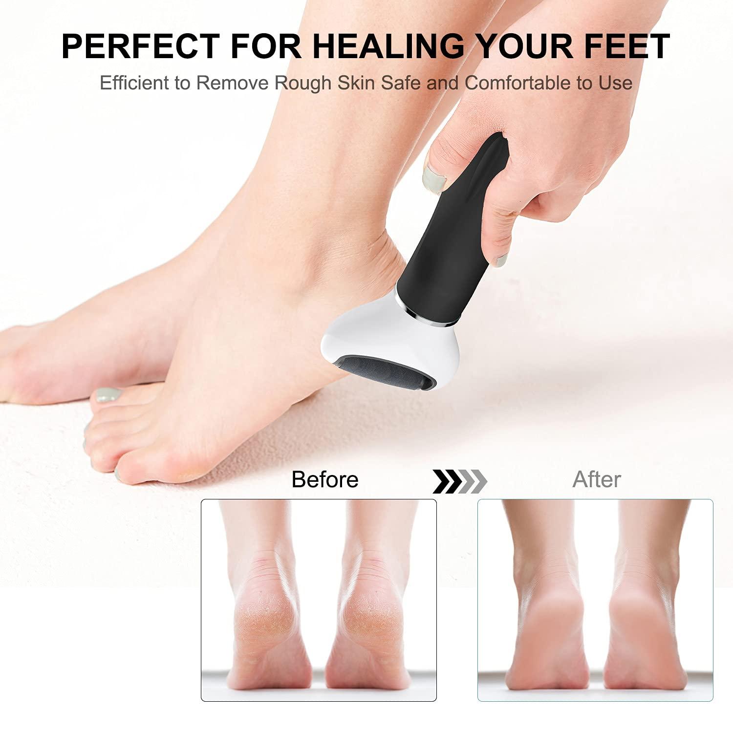 Electric Foot File, Ratukall Hard Skin Remover, Rechargeable