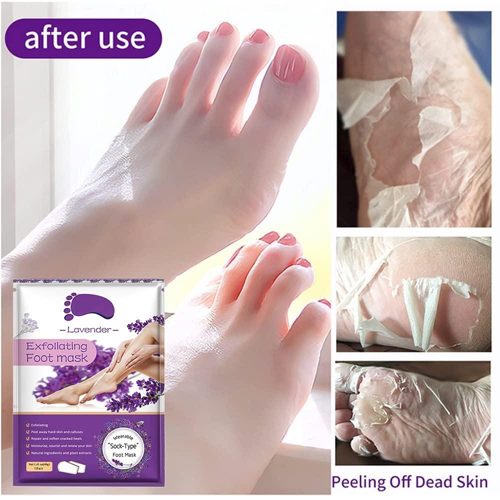 Foot Peel Mask - 5 Pack, Exfoliating Feet Mask For Soft Skin, Repair Dead Skin, Calluses, Cracked - Lavender