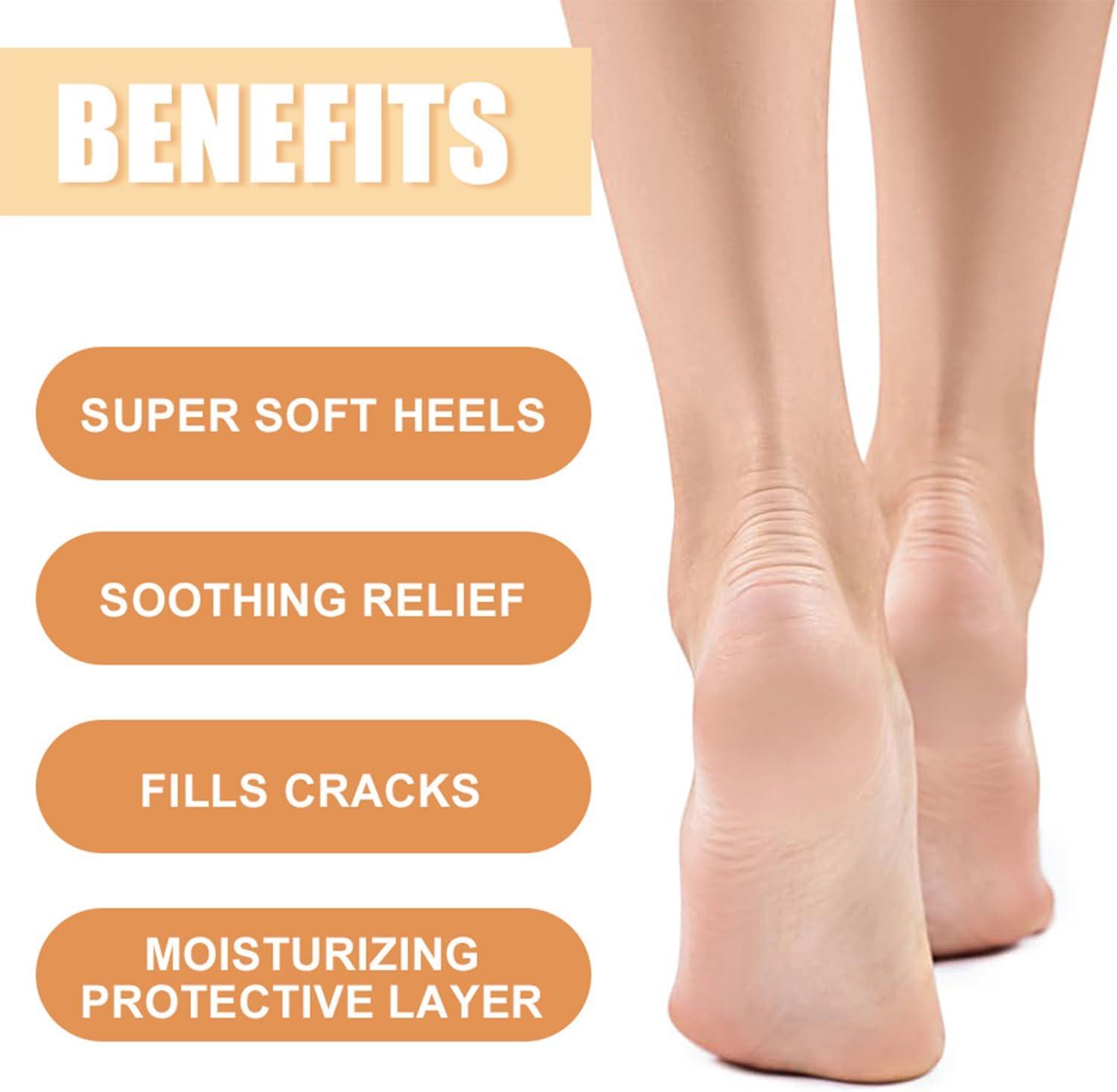 Honey Foot Cream Hand Heel Cream for Very Dry Hands Feet (40