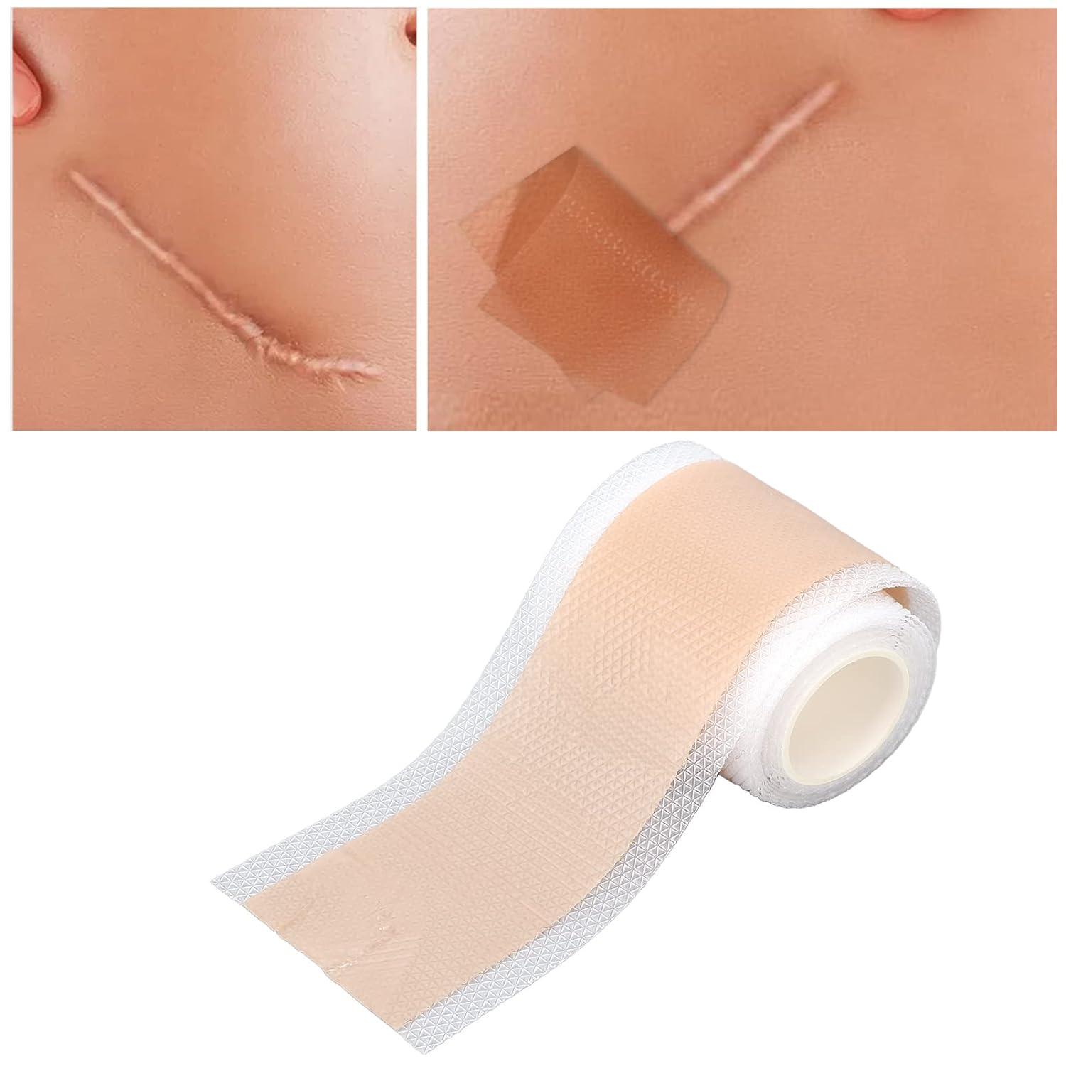 Scar Removal Tape Reduce Hyperplasia 59.1in Scar Tape Roll Improve Metabolism for Scar