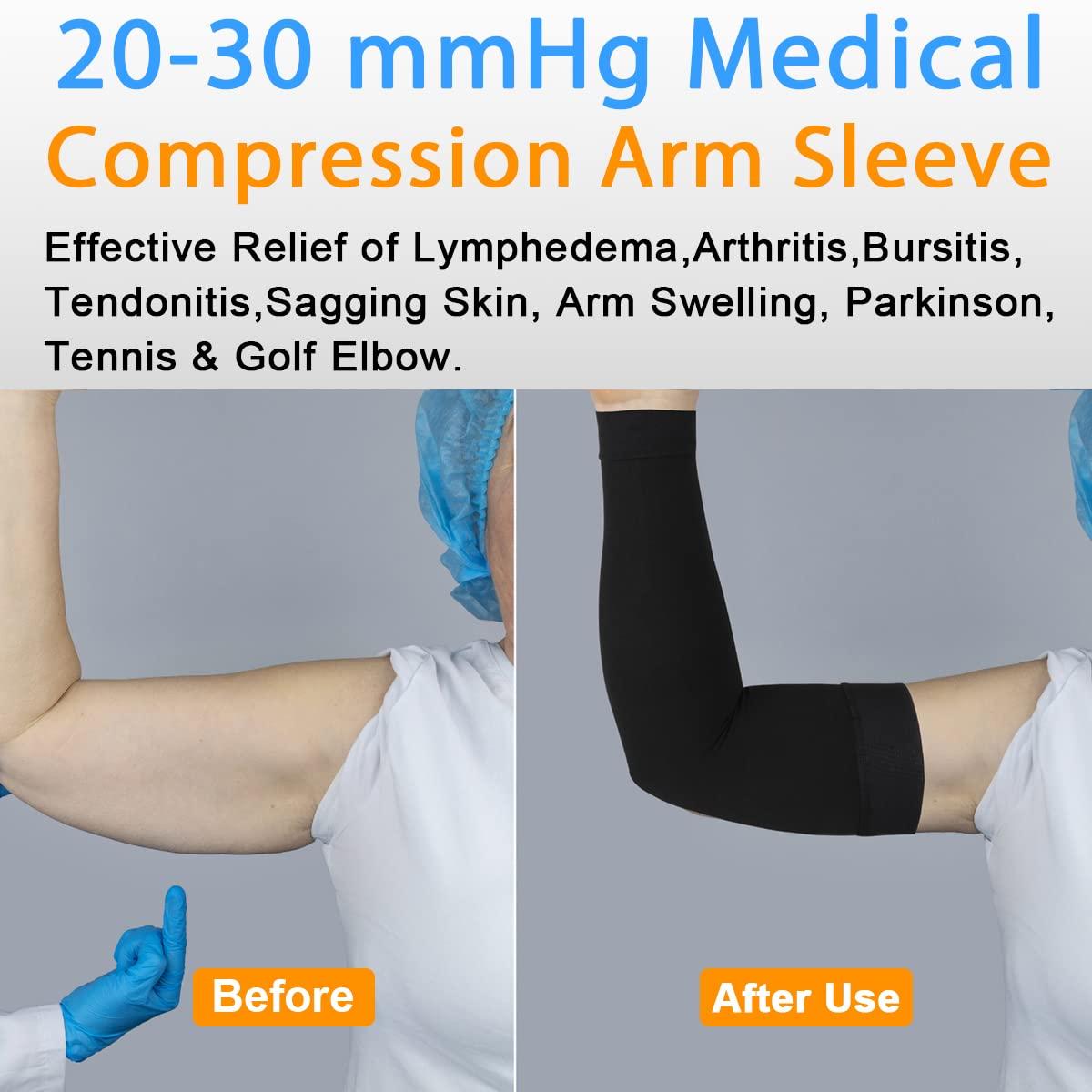 Mediven 20-30 mmHg Firm Support Arm Sleeves - HAS-20-30