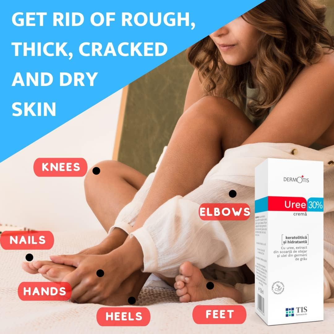 TIS HRERN MARN Urea Cream 30% 50g for Eczema Psoriasis Dry Skin