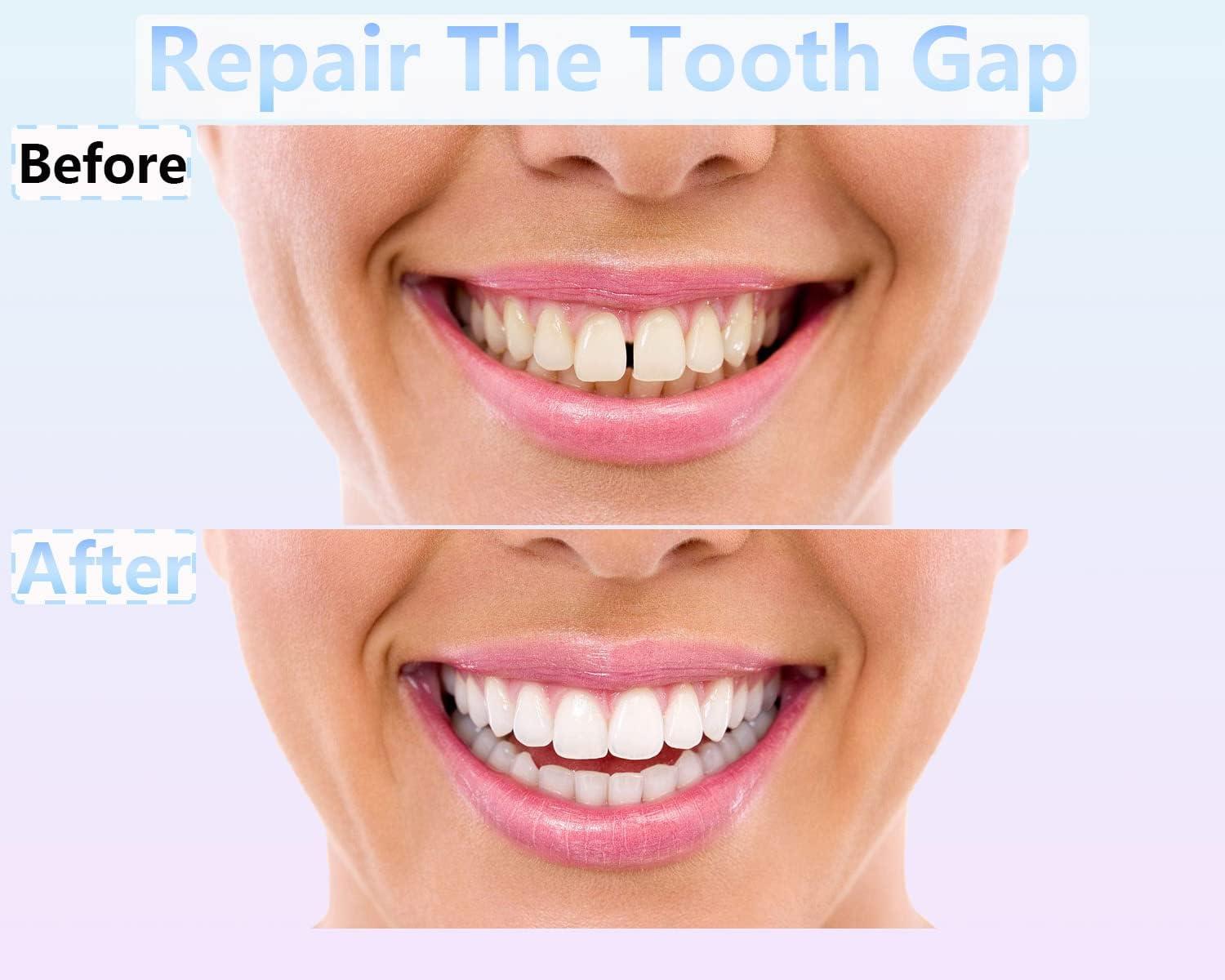Temporary Tooth Repair Beads Teeth Filling Replacement for Chipped