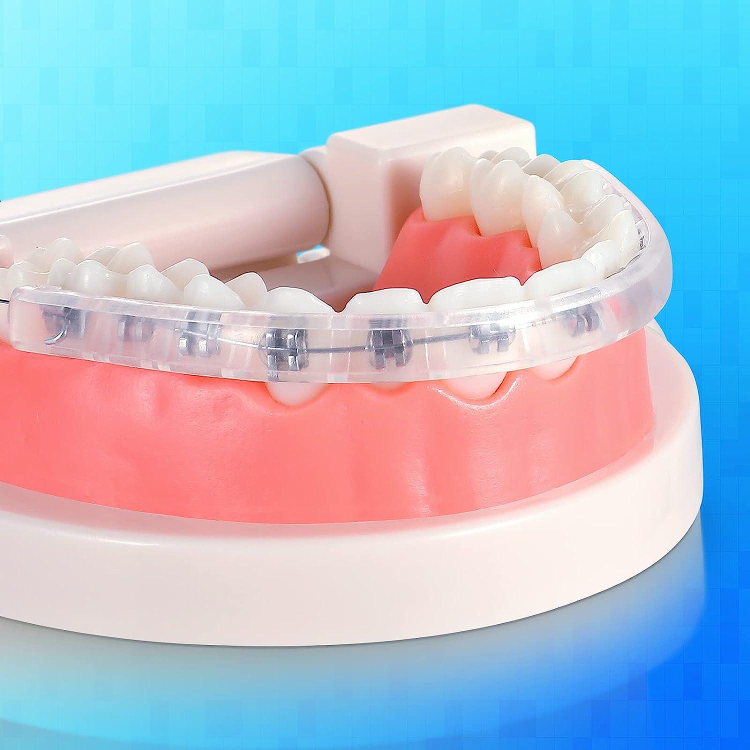 Obrush Clipon Comfort Covers for Braces Orthodontic Lip Protector