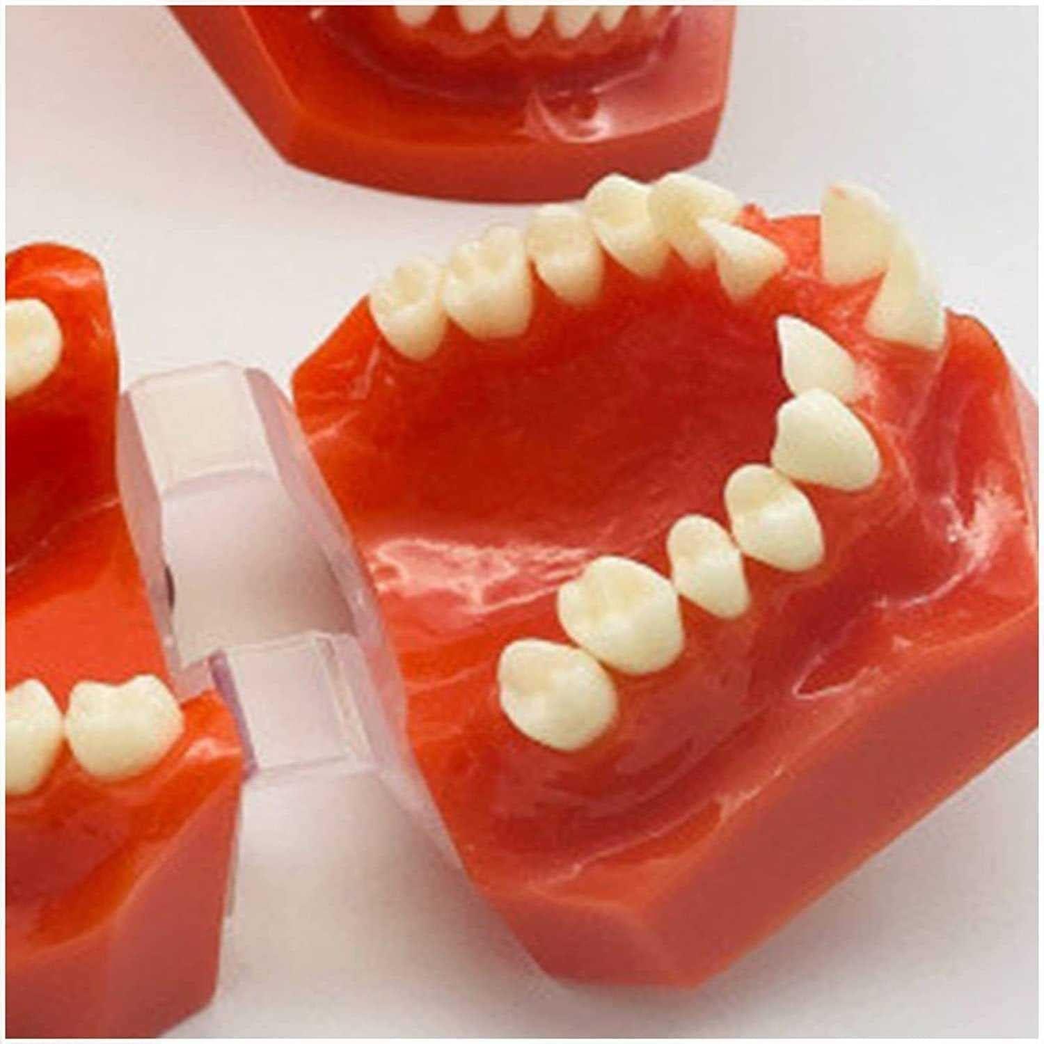 Teeth Educational Model - Orthodontic Classification & Lesson Model for ...