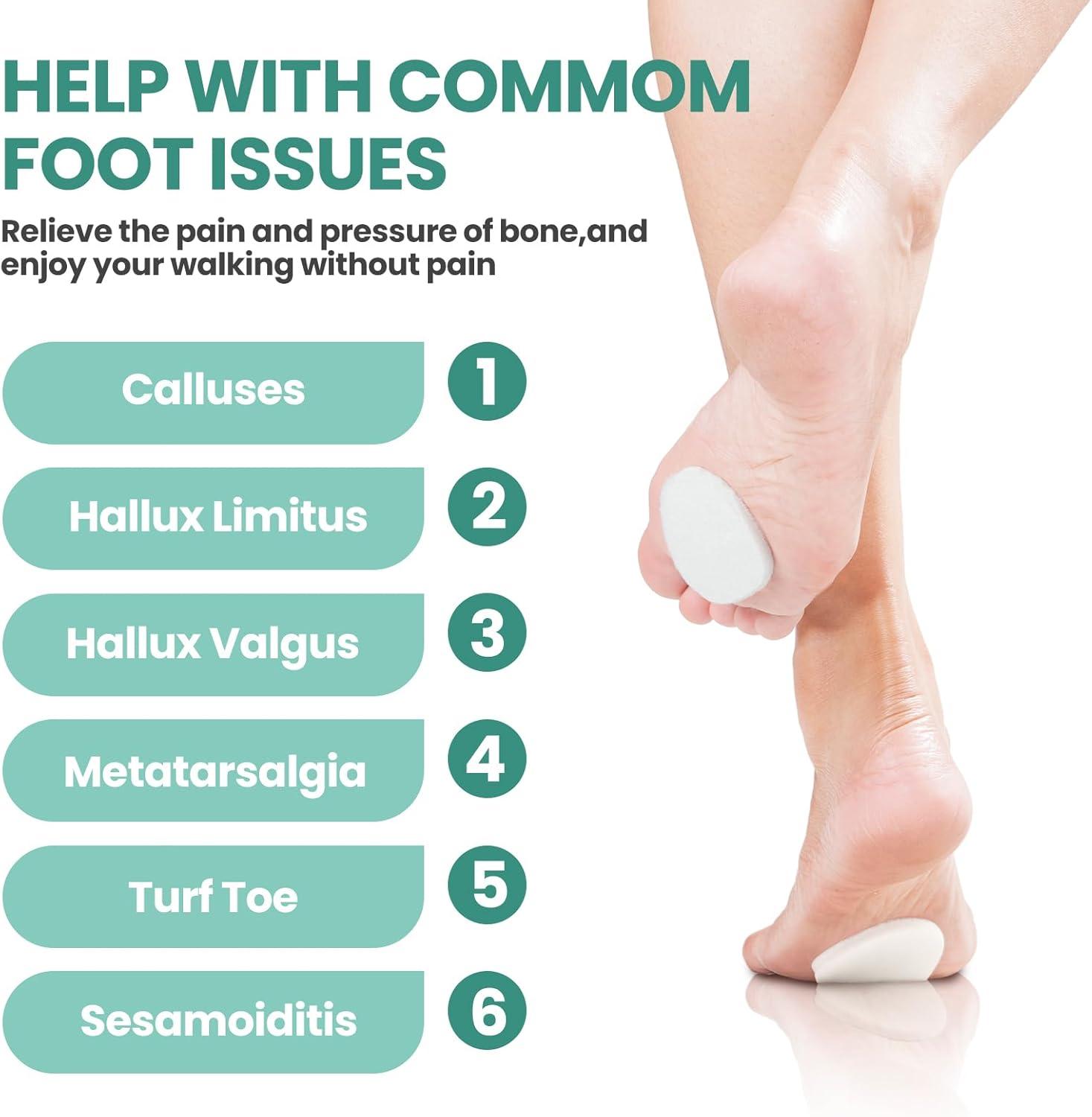Metatarsalgia Sole Of Foot Pain After Walking Metatarsalgia Sharp