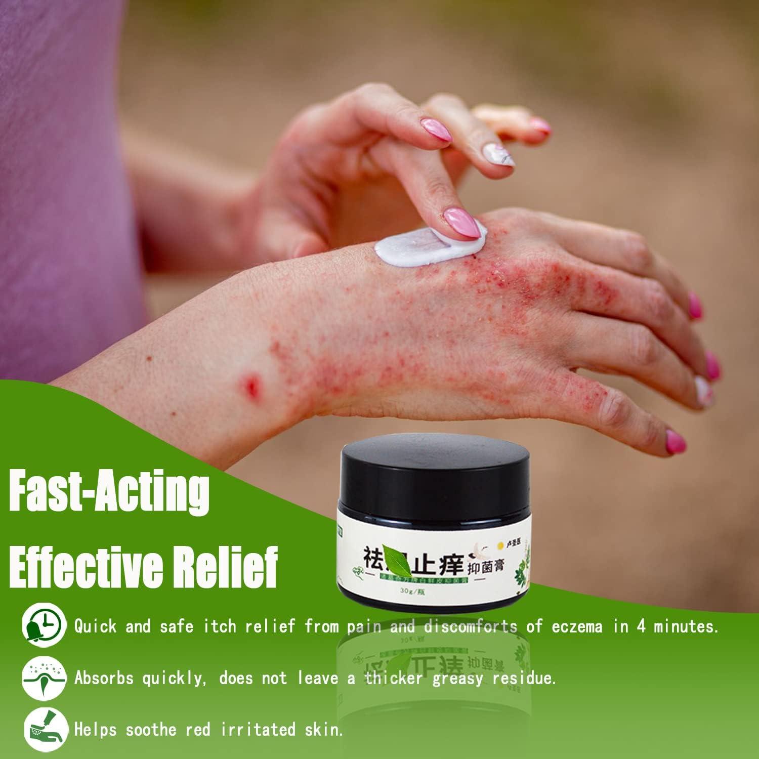 Natural Chinese Herbal Eczema Psoriasis Cream | Anti-Itch Dermatitis  Treatment | Moisturizing Ointment for Red, Dry Irritated Skin (1.06oz) |  Buy Now with Express International Delivery | GoSupps.com
