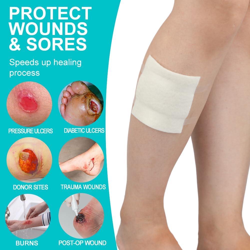 Buy 4x4 Calcium Alginate Wound Dressing - Non-Adhesive Highly Absorbent  Ideal for Pressure Ulcers Bed Sores Diabetic Foot Ulcers & Burns - Pack of  10 ...