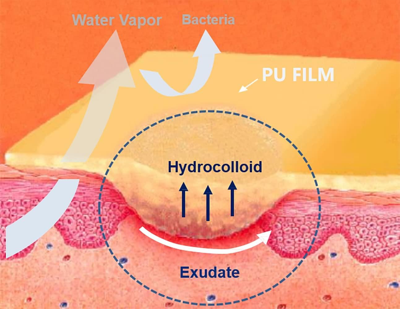 Hydrocolloid Adhesive Bandage 4'' x 4'' Box of 10 Dressings