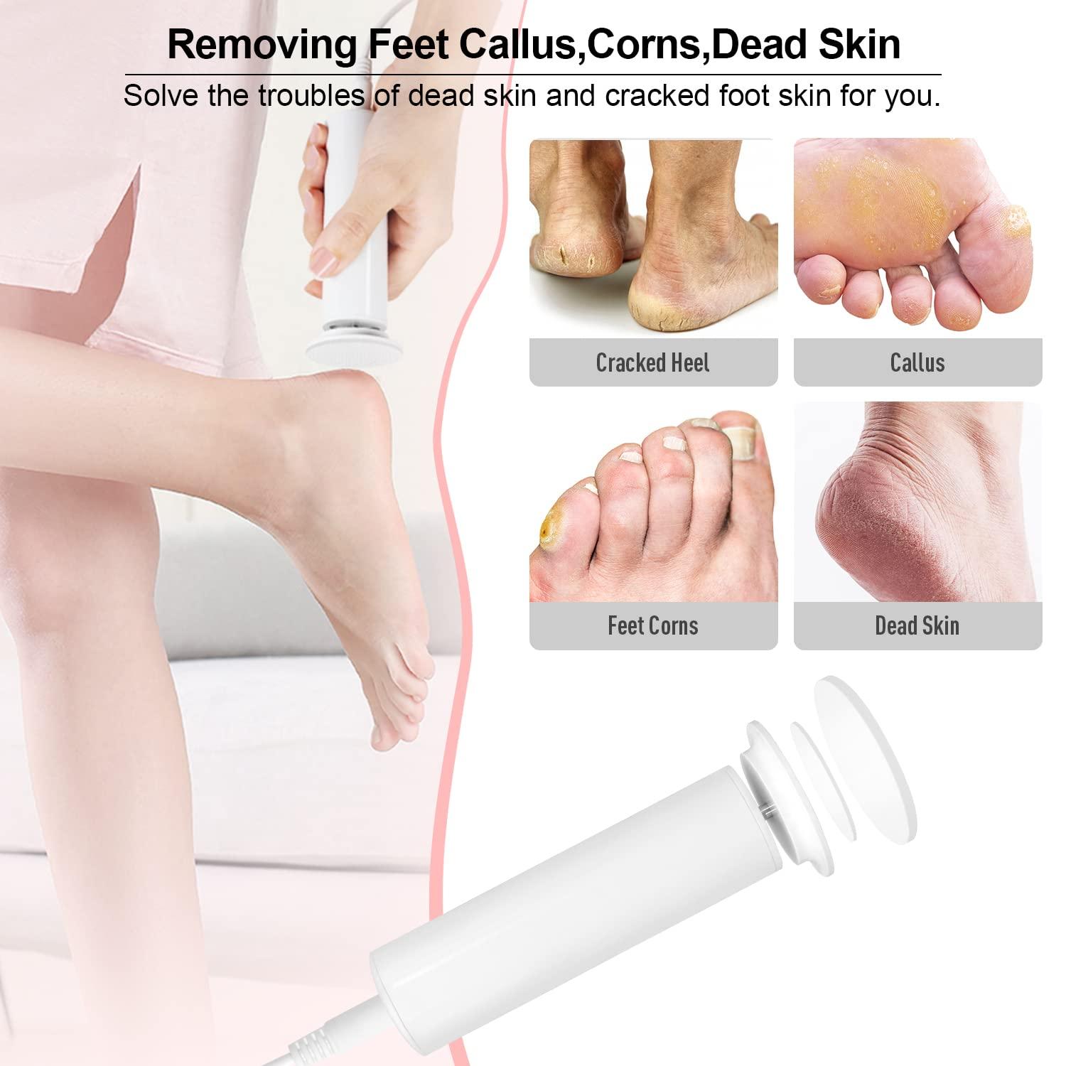 Pedicure Knife Callus Remover Tool, Silver Professional Heel Scrubber Dead Skin  Remover Pedicure Foot Care Tools for Men Women