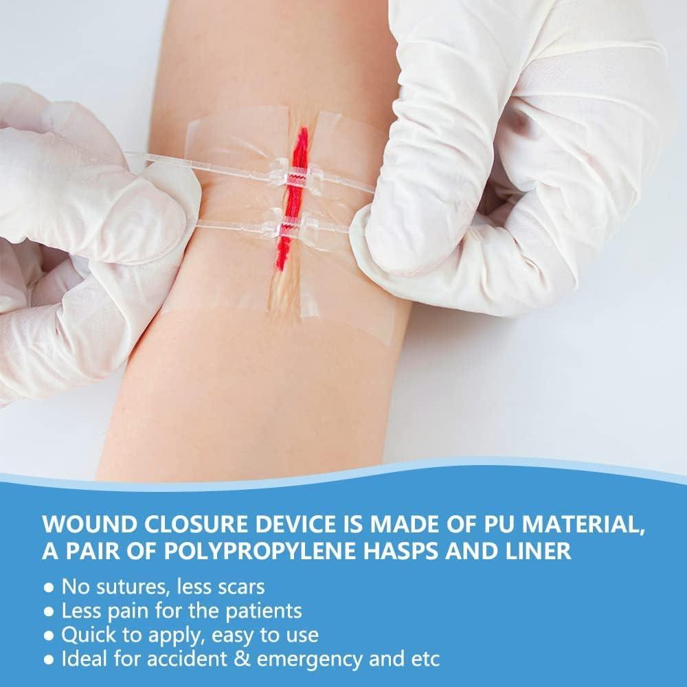 SMERPHOX Wound Closure Strip Sterile First Aid Band Kit Zip and Stitch