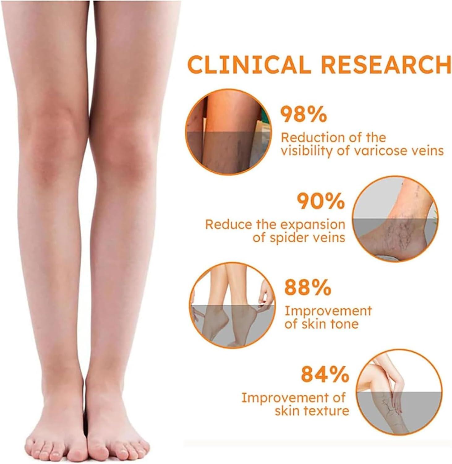 DAPANGGE Turmeric Varicose Vein Patch Turmeric Varicose Vein Patches Varicose Veins Patch Relief Varicose Veins Treatment Patch Naturally Relieves Varicose Veins in Legs and Spiders One Box | Buy Now with Express