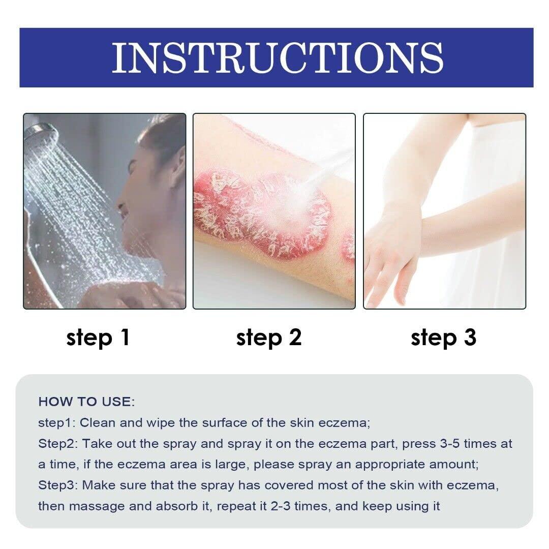 Itching Treatment Cream Spray Pruritus Skin Care AntiItch Treatment