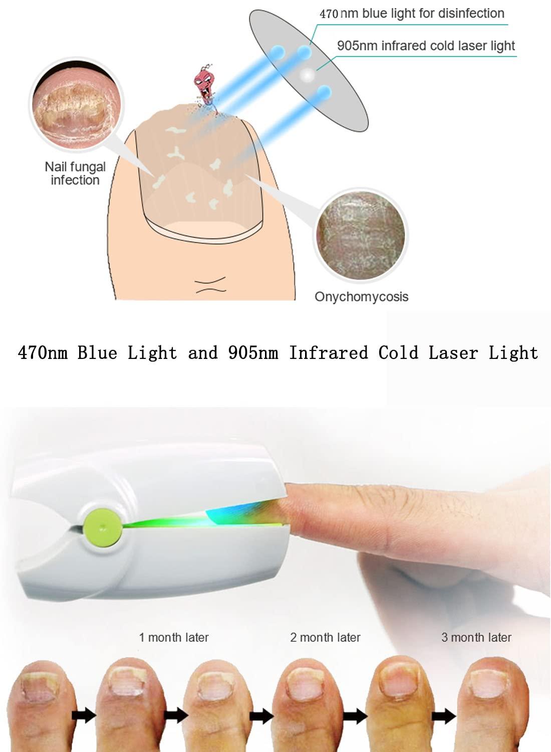 Nail Health Care Device Gentle Repair Daily Maintenance