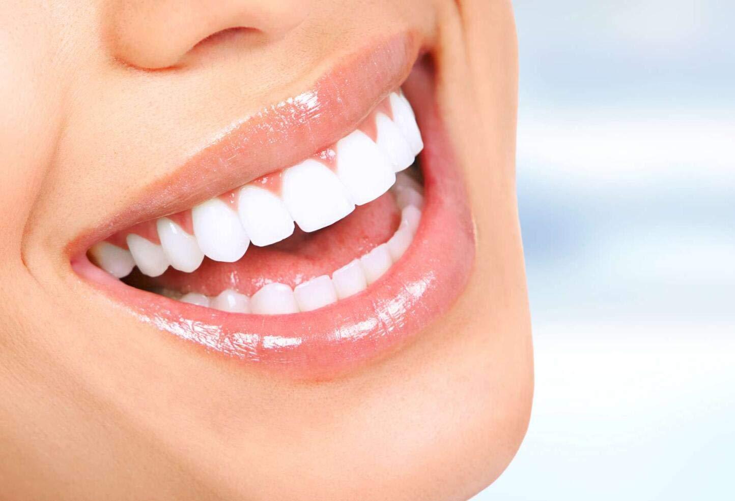 VINFANY Orthodontic Tips - Thumbnail 2
