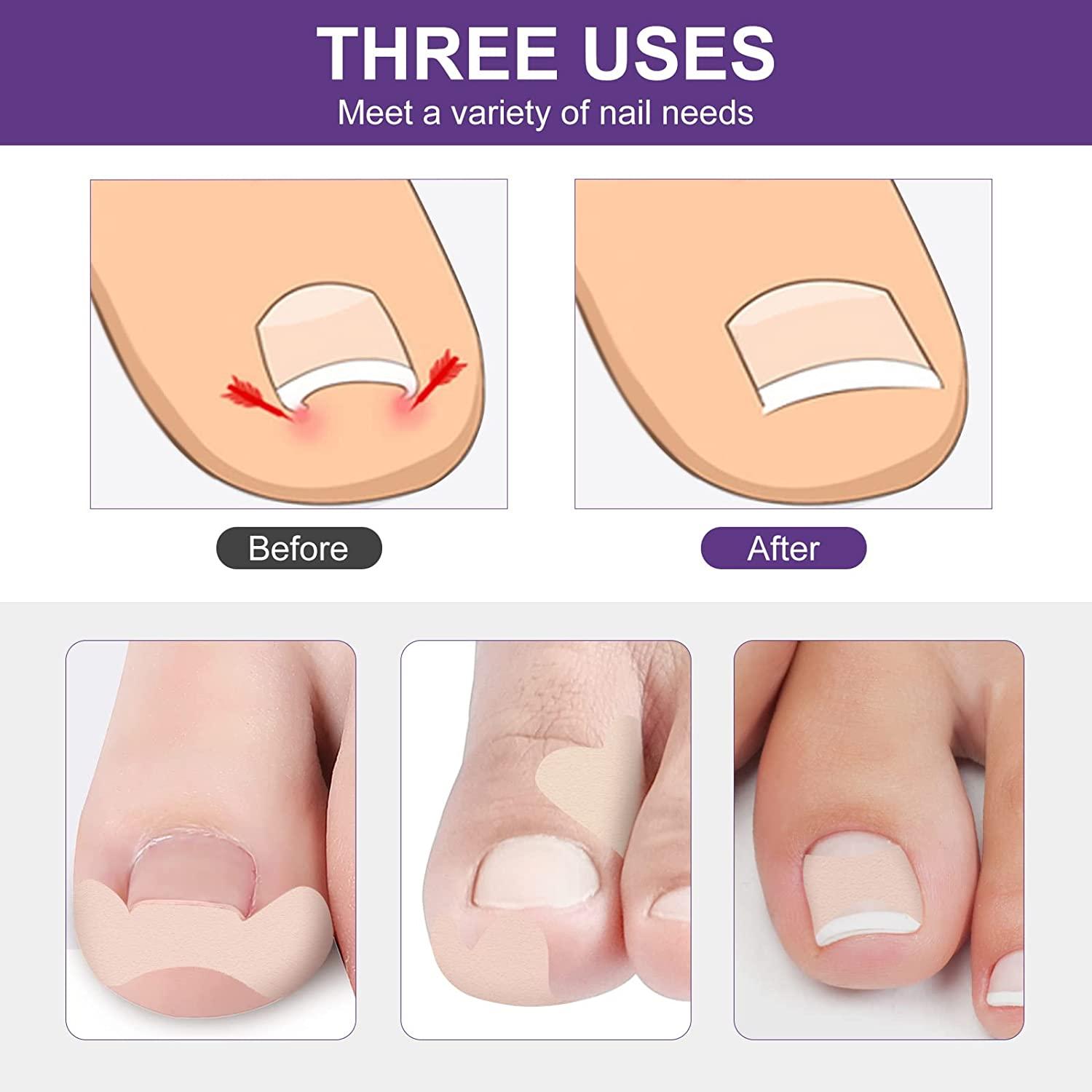 7 Common Causes of Big Toe Pain