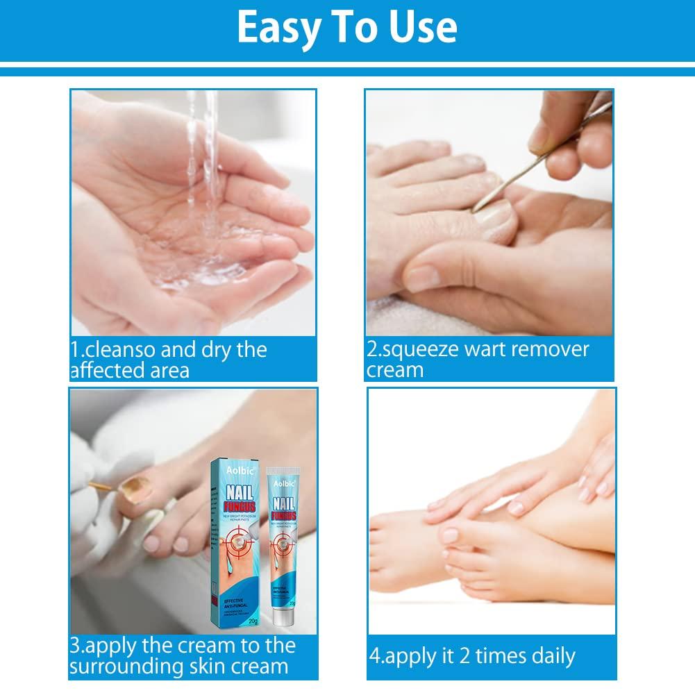 Best Nail Repair Cream for Fungus Treatment Restores Discolored Nails Toe & Finger Care