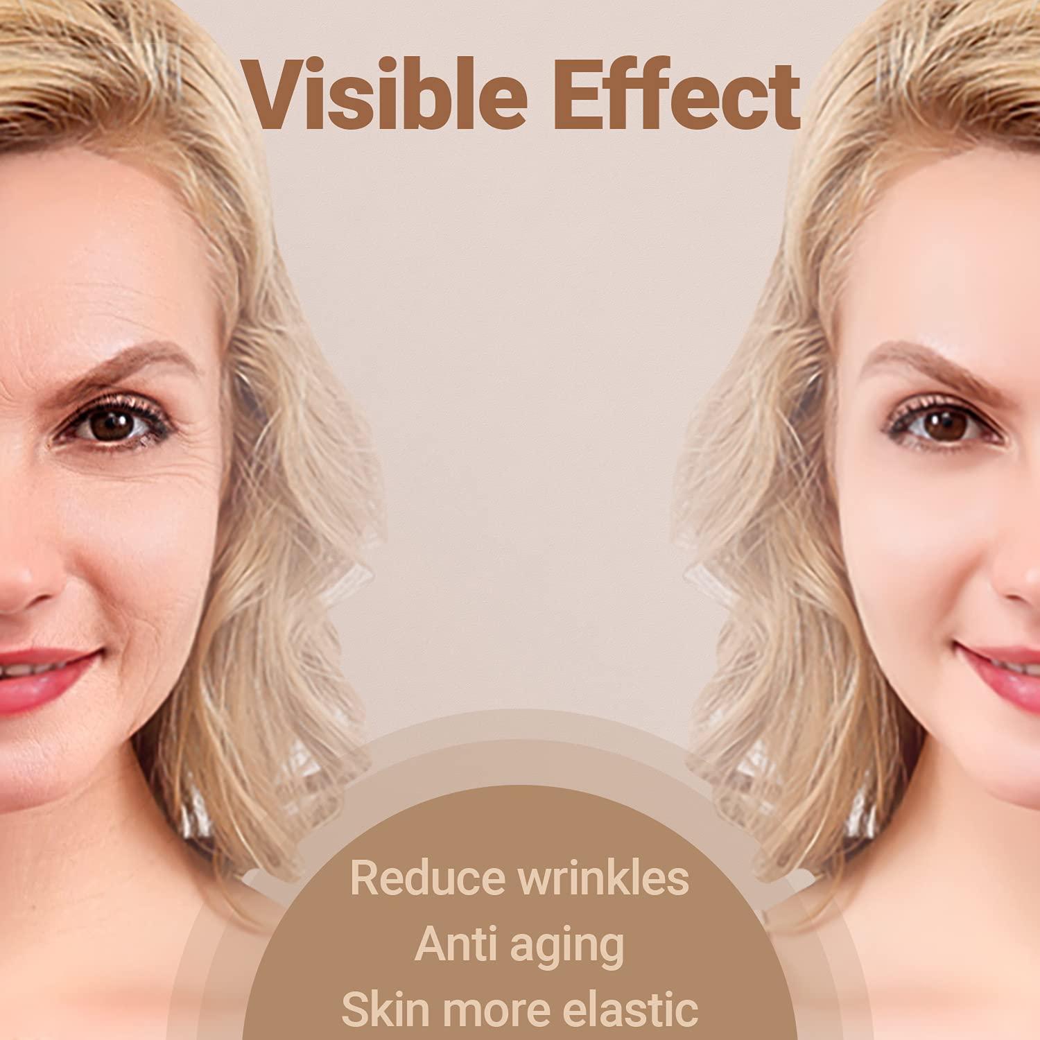 ION Photon Therapy Facial Skin Lifting, Skin Tightening Anti-Aging