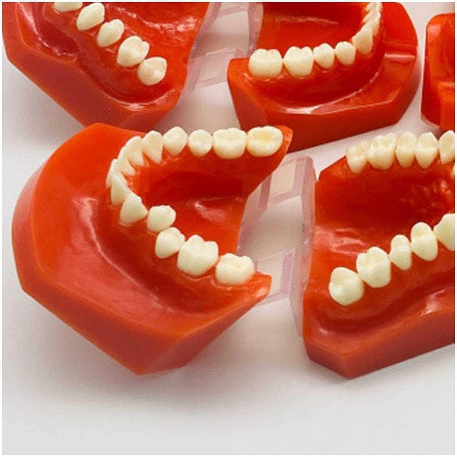 Teeth Educational Model - Orthodontic Classification & Lesson Model for ...