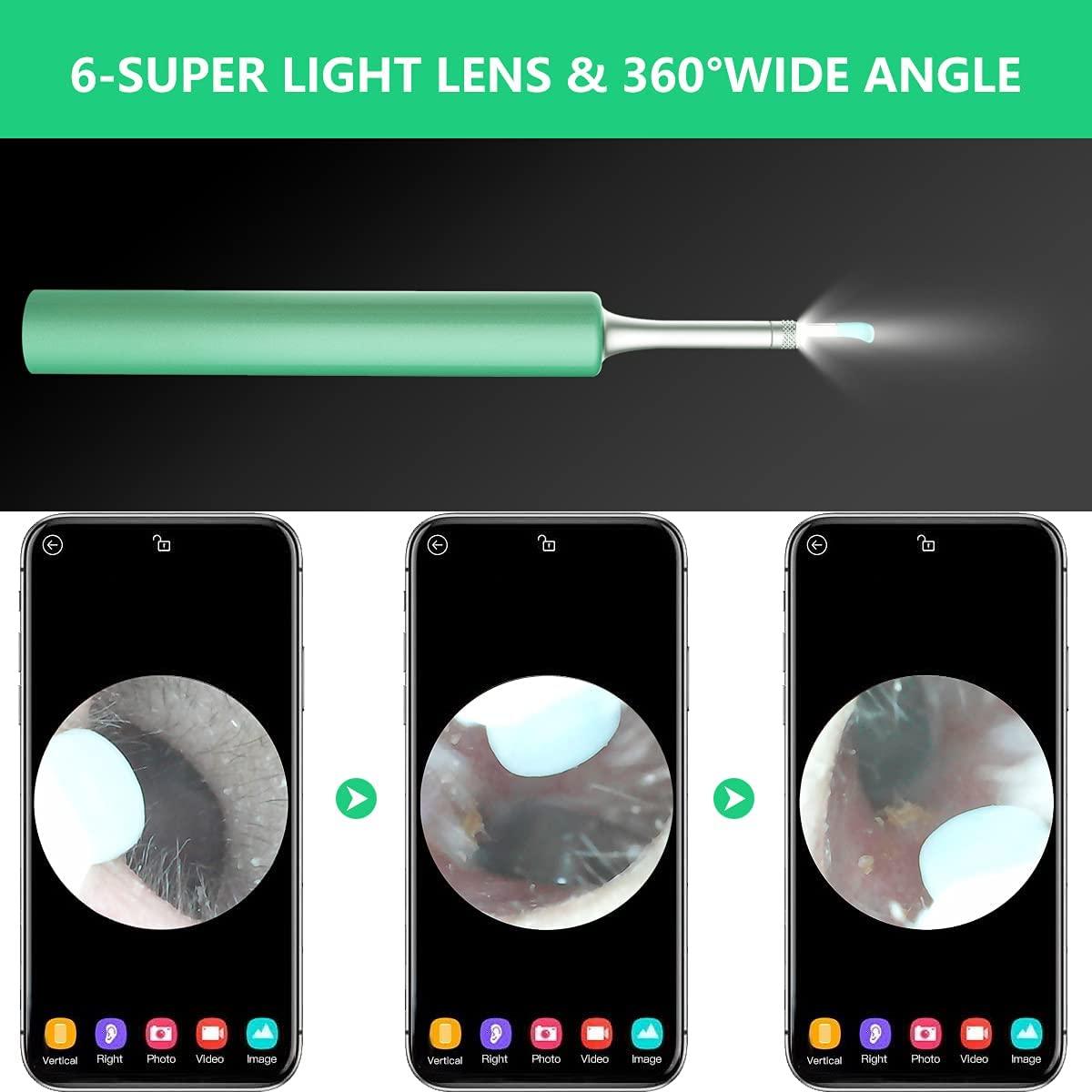 DJROLL Ear Wax Removal Endoscope, Earwax Remover Tool, Ear Camera,1080P