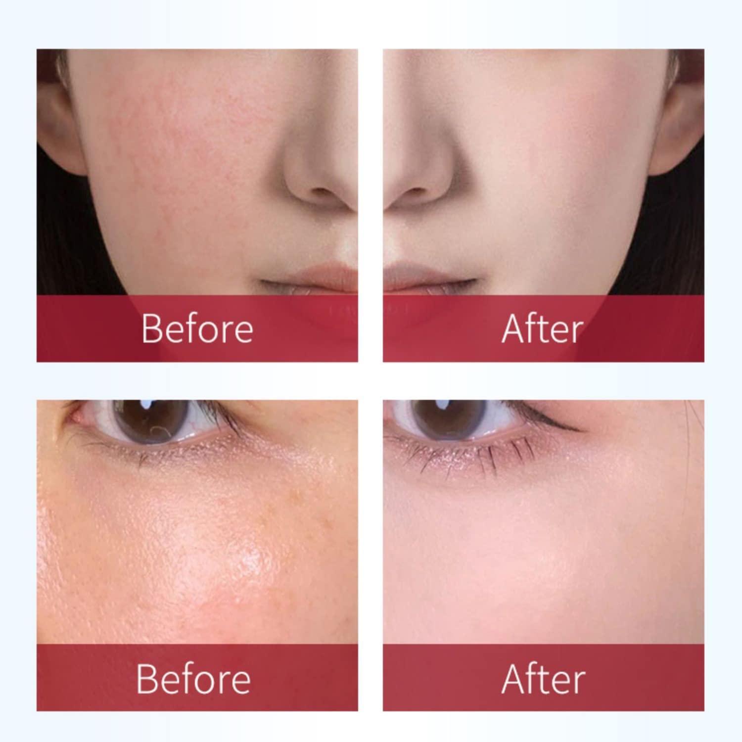 Rosaderm Fast Gel Cream Skin Tint Corrective Anti Redness Primer