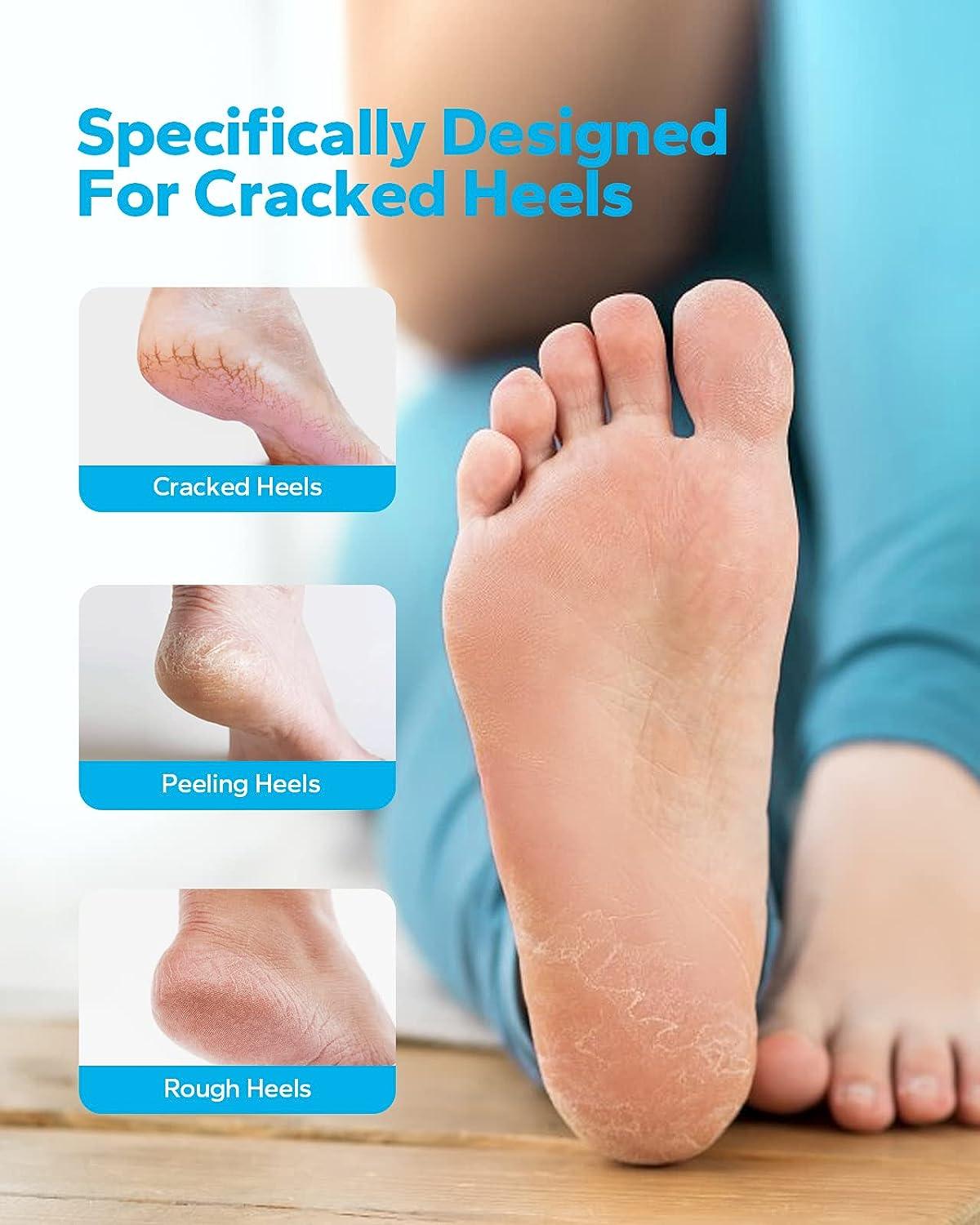 10 Best Foot Creams in India for Dry Feet & Cracked Heels - Heart Bows &  Makeup